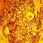Alien Autopsy: Inside the Brain