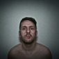 Self Portrait with Cold sore