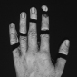 Hanne's Broken Hand I