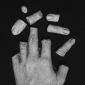 Hanne's Broken Hand II