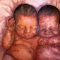 Twins