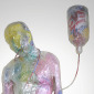 Intravenous 