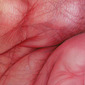 Flesh Field No.4